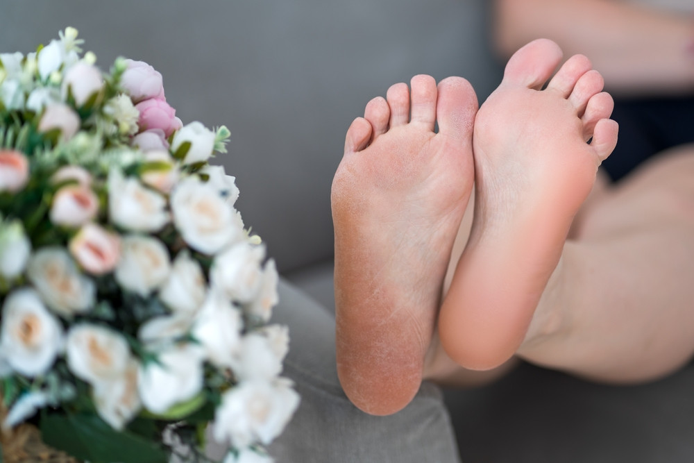J’ai les pieds secs, que faire ?