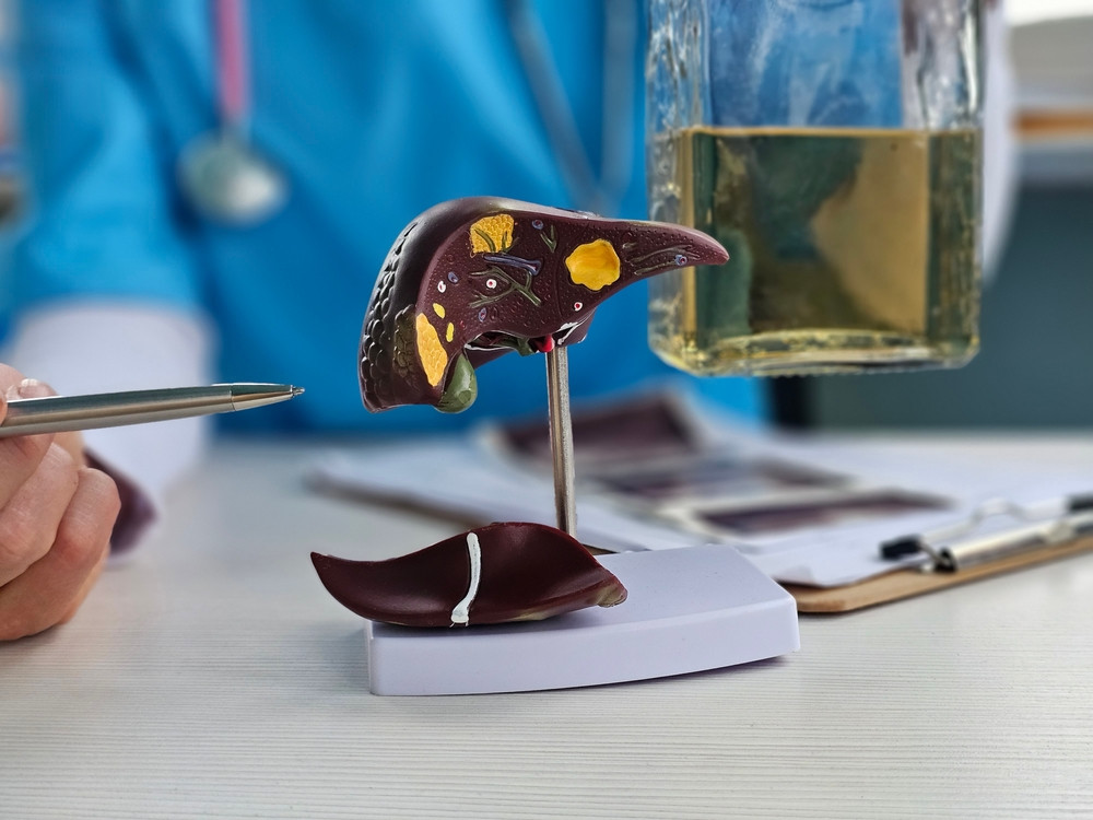 Tout savoir sur la maladie du foie gras