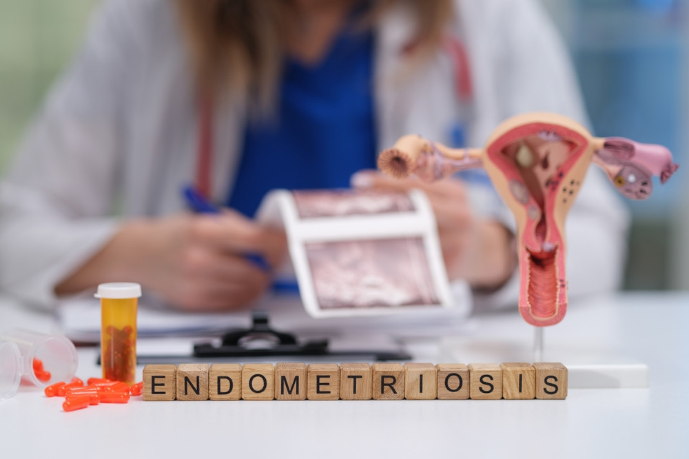 5 étirements pour soulager l’endométriose