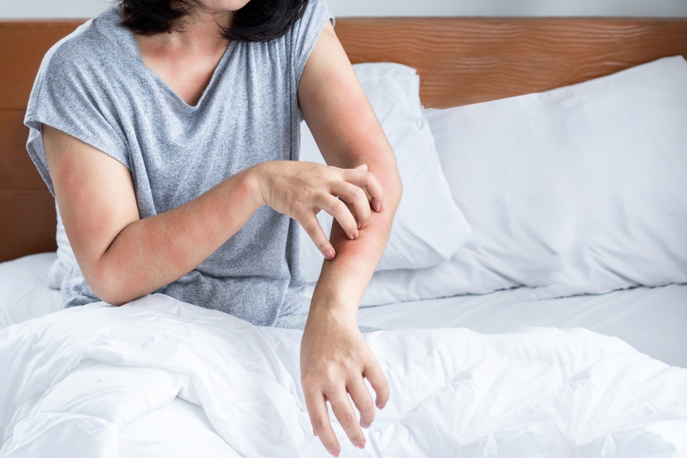 Comment savoir si l'on a des punaises de lit chez soi ?