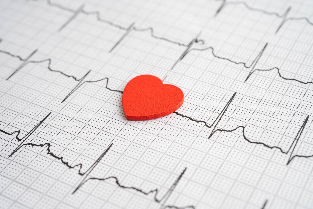Tout savoir sur l'arythmie cardiaque