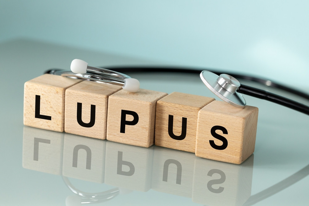 Lupus : les signes à surveiller