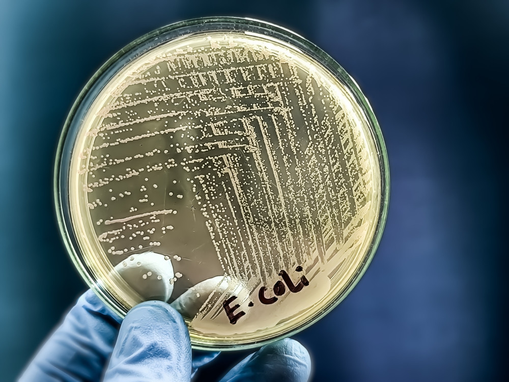 Tout savoir sur la bactérie Escherichia Coli