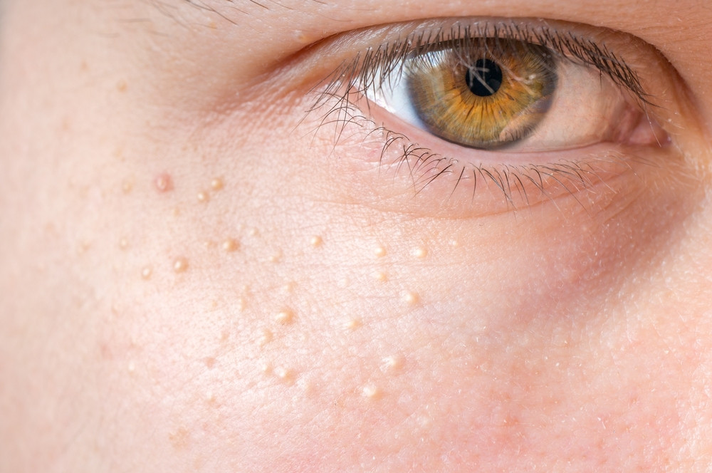Comment faire partir des grains de milium ?
