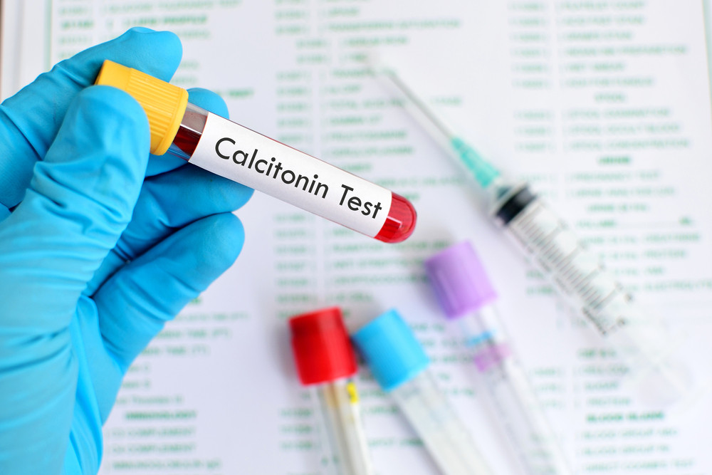 Qu'est-ce qui fait augmenter la calcitonine ?