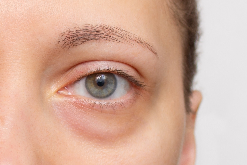 Comment maquiller des yeux fatigués ?