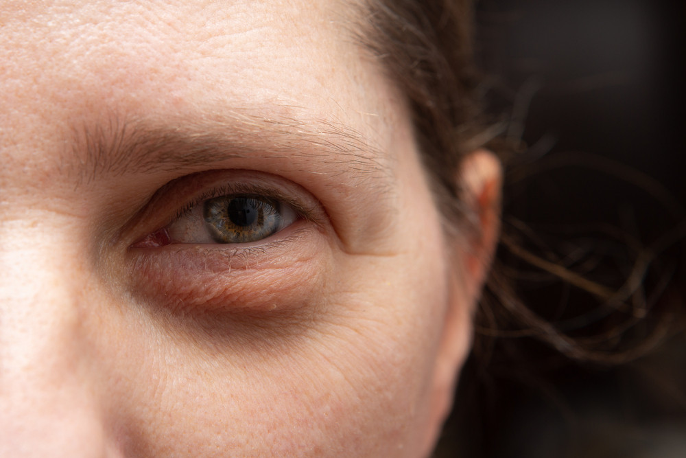 Poches sous les yeux ? Nos solutions