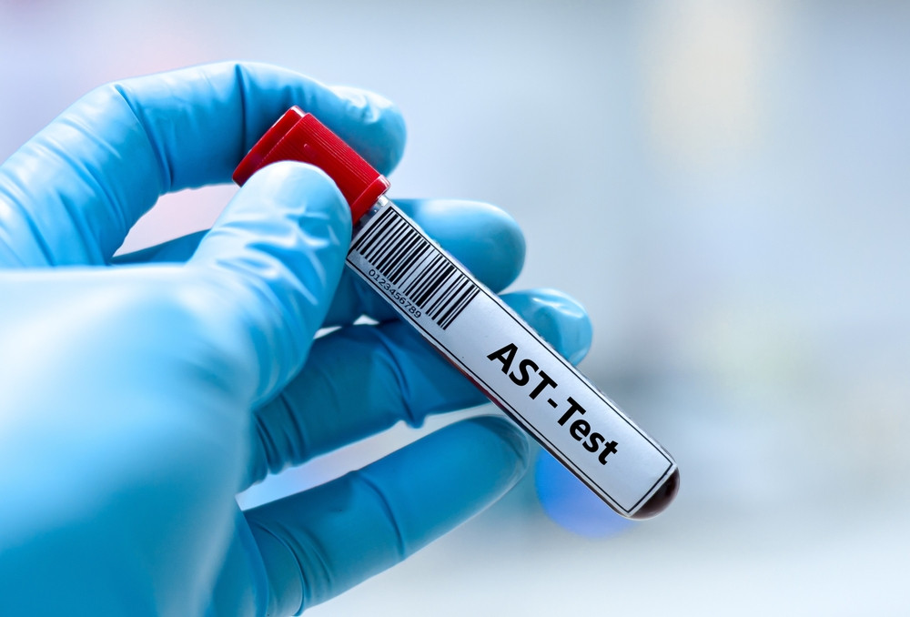 Transaminases élevées : quand s’inquiéter ?
