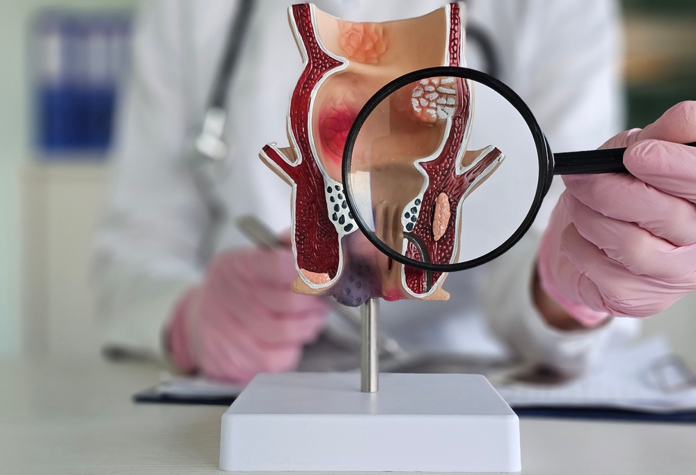 10 symptômes où il faut rapidement consulter un proctologue