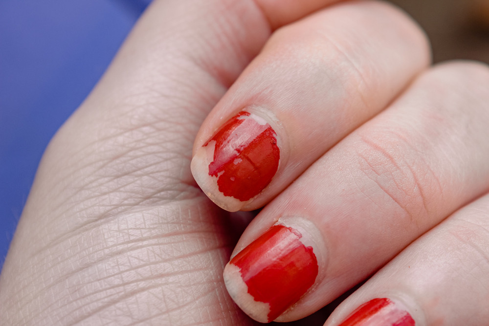 5 astuces contre le vernis qui s’écaille