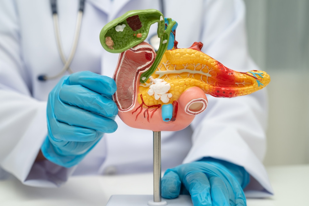 Tout savoir sur le cancer du pancréas