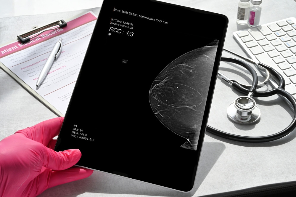 Est-ce qu'un cancer du sein se voit à la mammographie ?