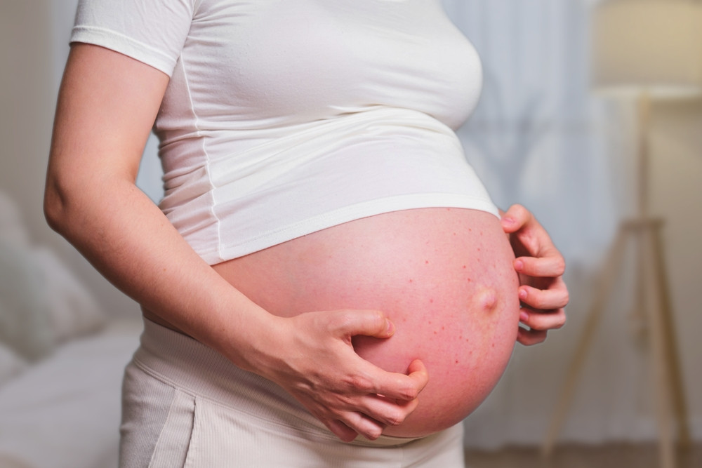 Problèmes de peau pendant la grossesse : symptômes et solutions