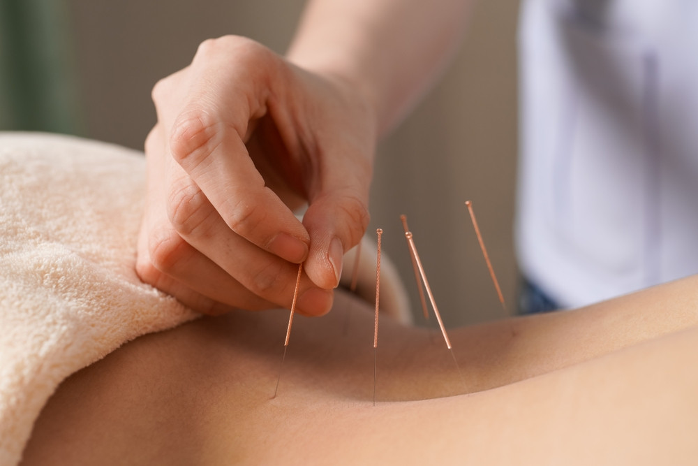 10 conseils d’acupuncteur pour se sentir mieux