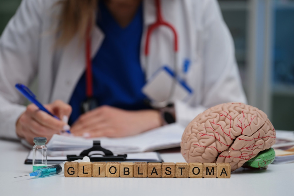 Tout savoir sur le glioblastome