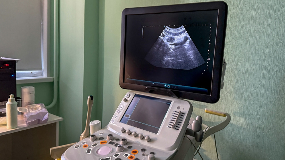 L'hydramnios : un excès qui soulève des questions cruciales