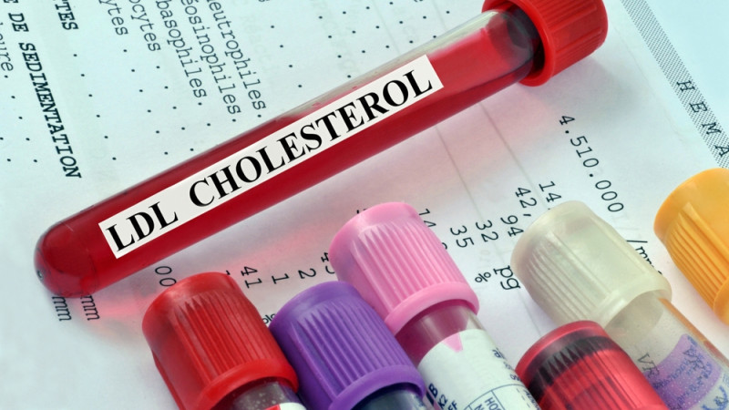 cholesterol
