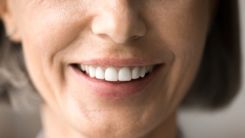 Mes dents bougent : que faire ?