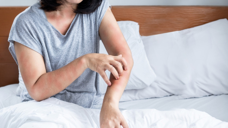 Comment savoir si l'on a des punaises de lit chez soi ?