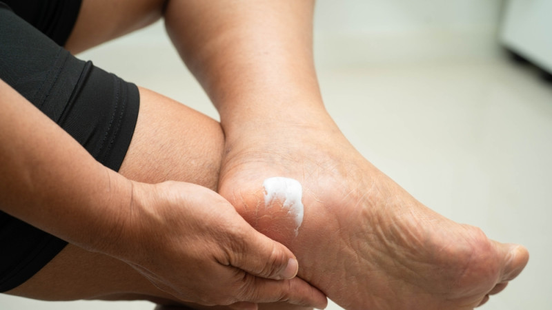 Comment prendre soin de ses pieds secs ?