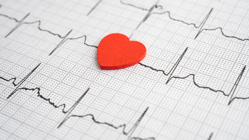 Tout savoir sur l'arythmie cardiaque