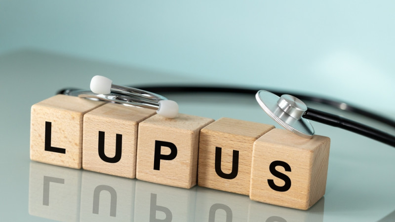 Lupus : les signes à surveiller