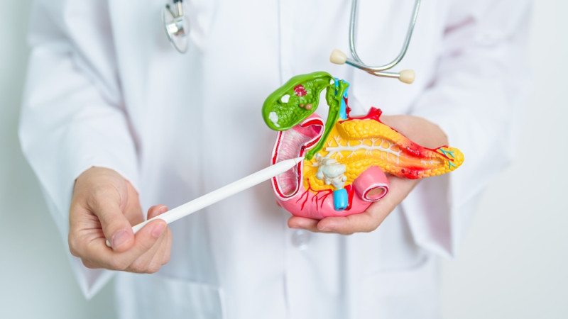 Comment réduire les risques de cancer du pancréas ?