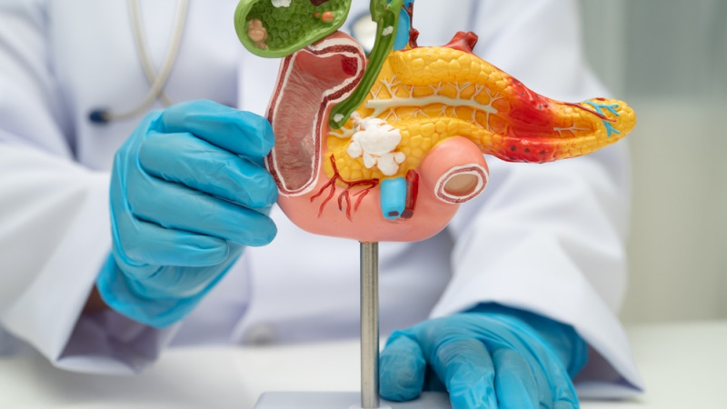 Quelle est l’espérance de vie quand on a un cancer du pancréas ?