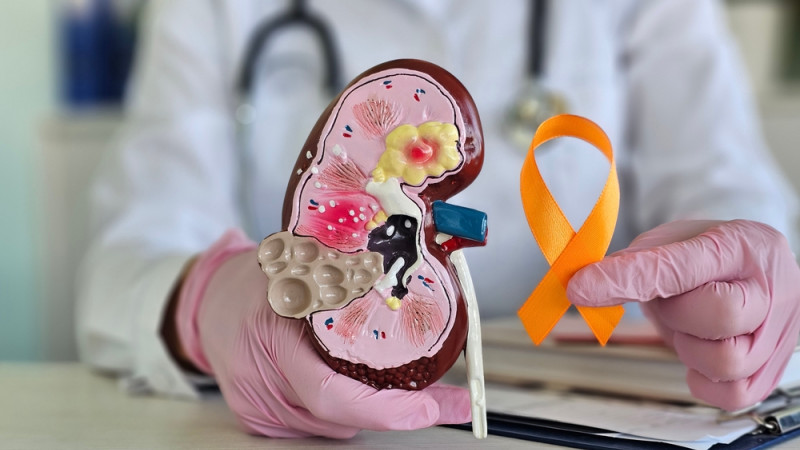 Cancer du rein : quels sont les premiers signes ?