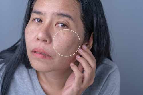 Comment éviter d’avoir le teint terne ?
