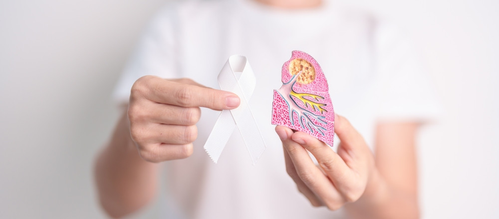 Quelle est l’espérance de vie quand on a un cancer des poumons ?