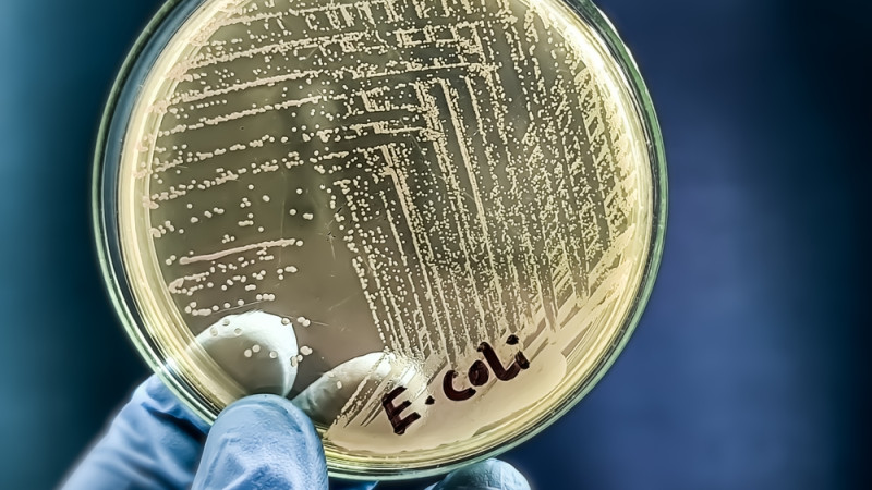 Tout savoir sur la bactérie Escherichia Coli