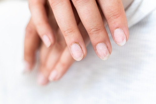 Gainage en gel : la méthode innovante pour des ongles naturels, forts et éclatants 