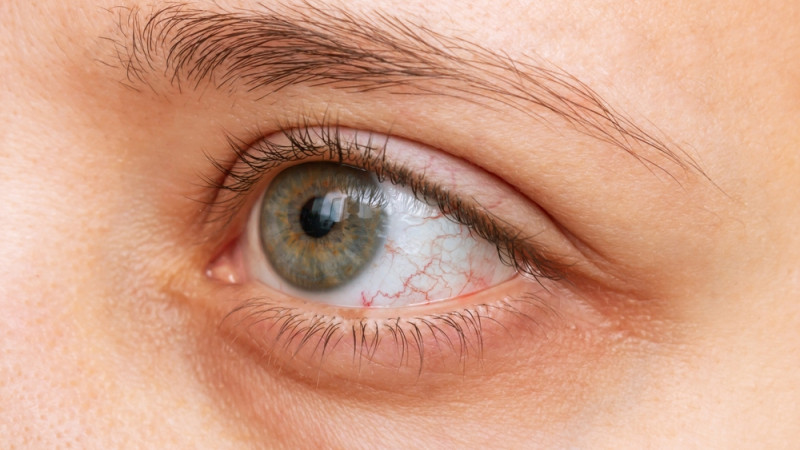 Sécheresse oculaire : quelles solutions ?