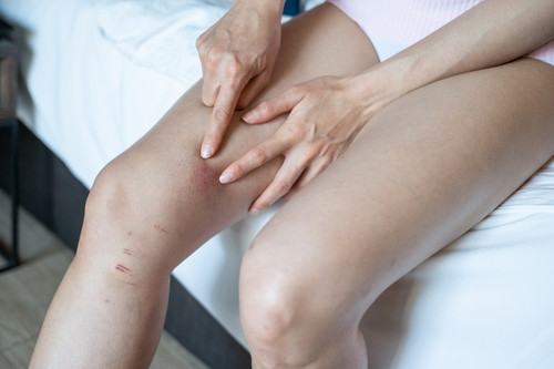 Cuisses molles : comment les raffermir ?