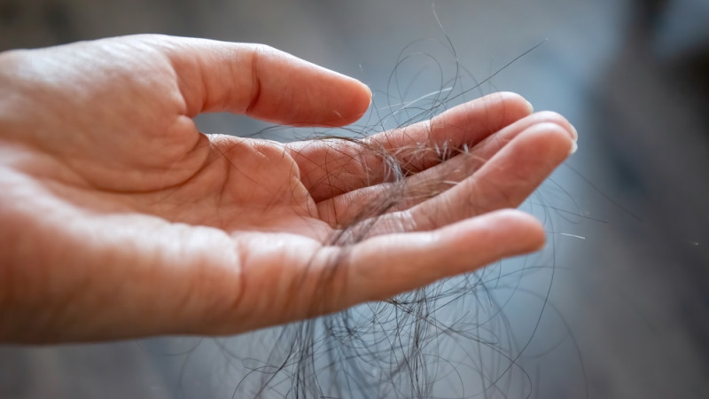 10 aliments qui affaiblissent vos cheveux