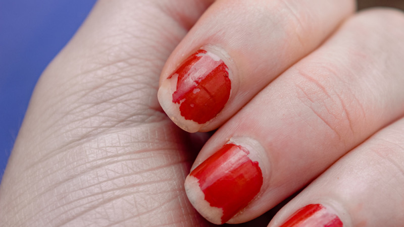5 astuces contre le vernis qui s’écaille