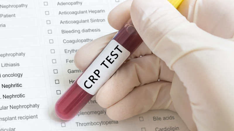 test CRP