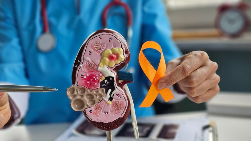 Quelle est l’espérance de vie quand on a un cancer du rein ?