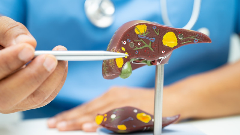 Quelle est l'espérance de vie pour le cancer du foie ?