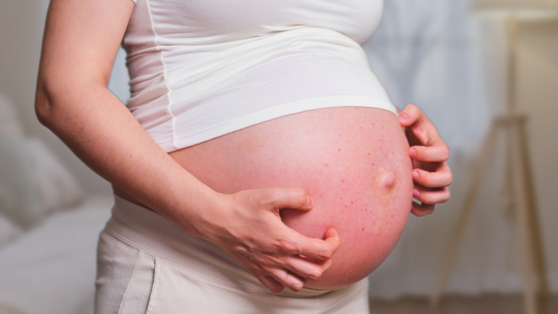 Problèmes de peau pendant la grossesse : symptômes et solutions