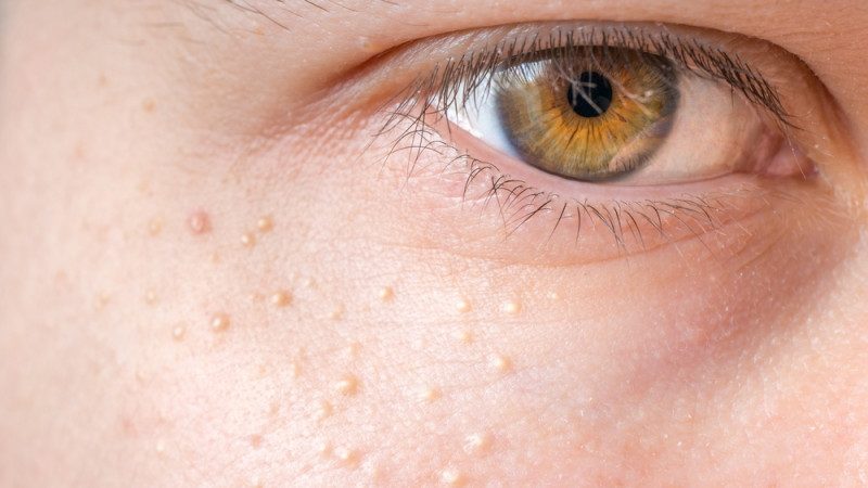 Comment extraire les grains de milium ?