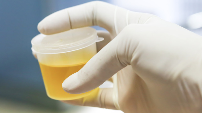 Urine mousseuse : un signe à ne pas négliger pour vos reins
