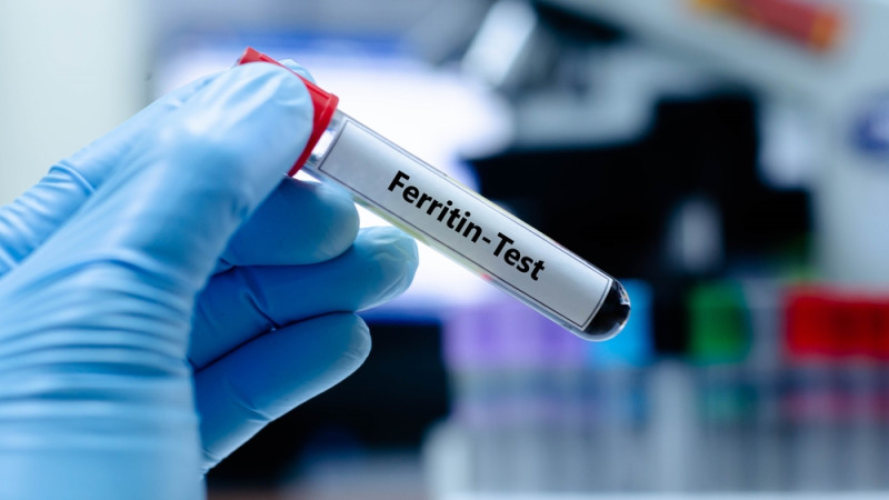 Quelles sont les causes d’un taux élevé de ferritine ?