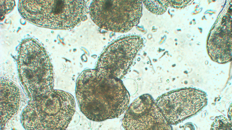 C’est quoi la maladie du renard (échinococcose alvéolaire) ?