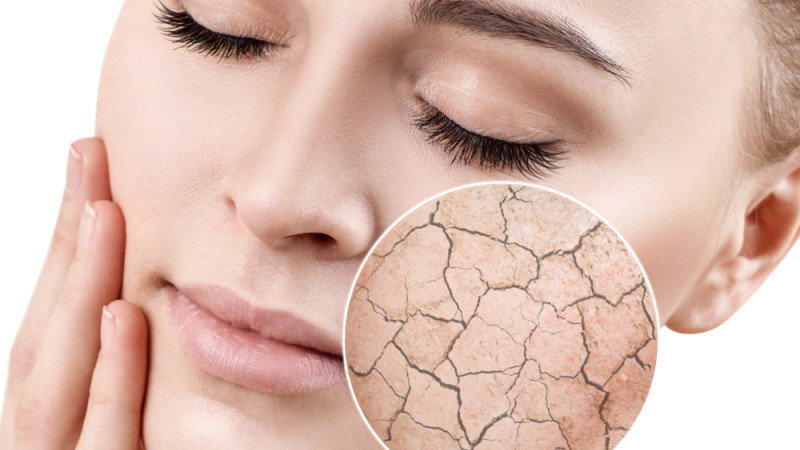 Suis-je déshydraté sans le savoir ?