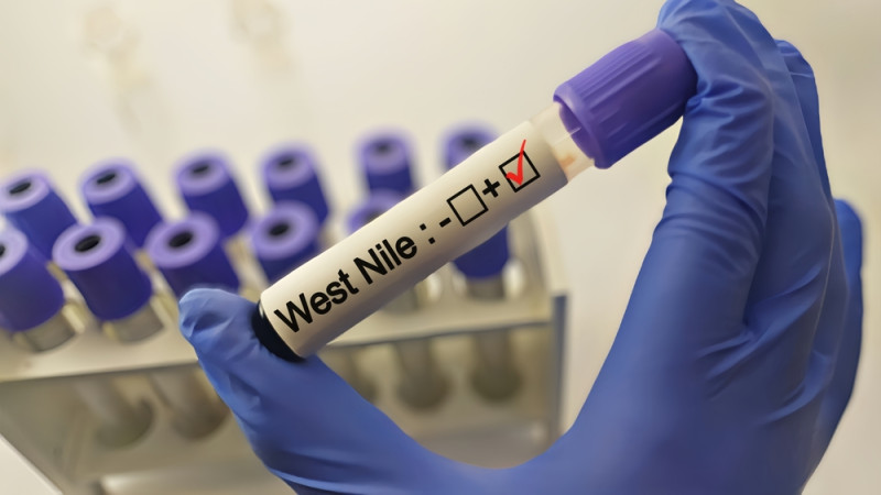 Tout savoir sur le virus de Nil
