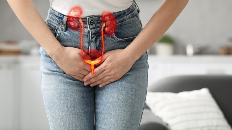 La cystite : un signe avant-coureur de cancer ?