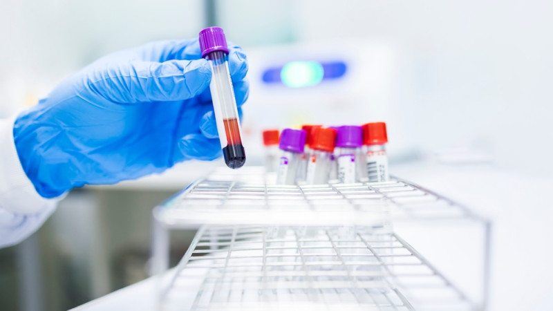 Syndrome hyperéosinophilique : enjeux et mystères à percer