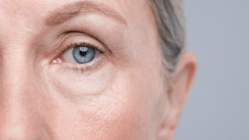 Tout savoir sur la rétinite pigmentaire